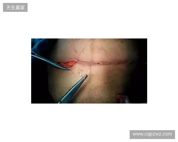 广州豹官方：杨浩眉弓伤口缝合30余针，预计5-7天后拆线